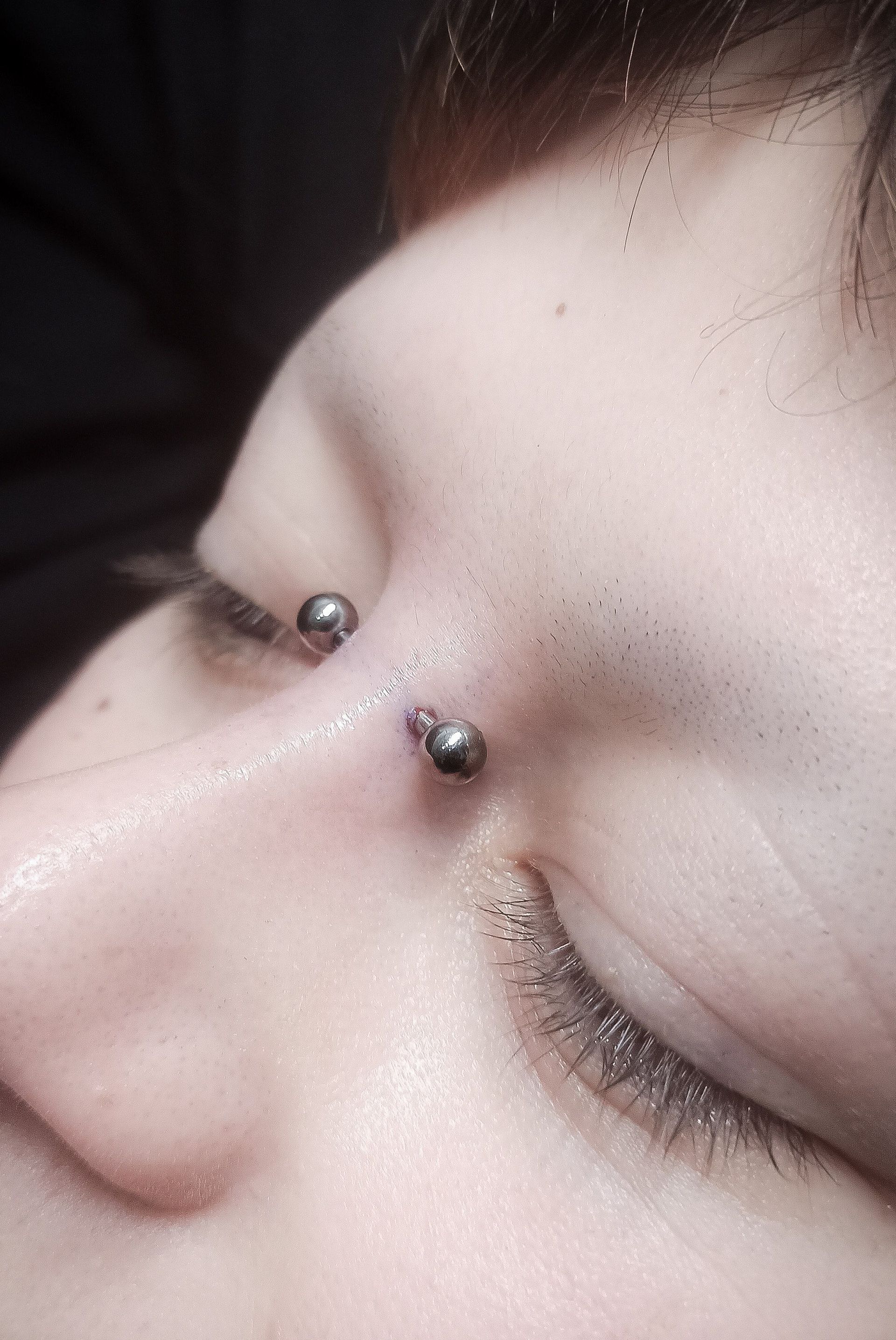 Primer plano de una nariz con dos perforaciones: una perforación en el puente y una perforación en la fosa nasal alta.