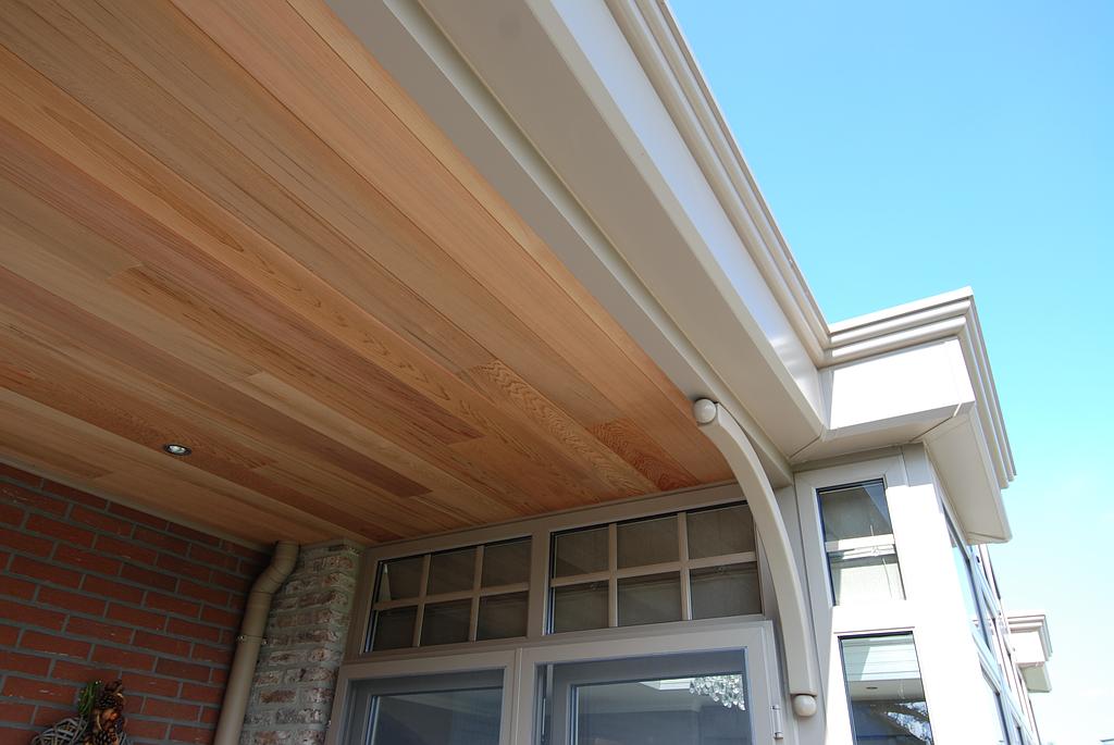 Détail d'une pergolas en aluminium blanc