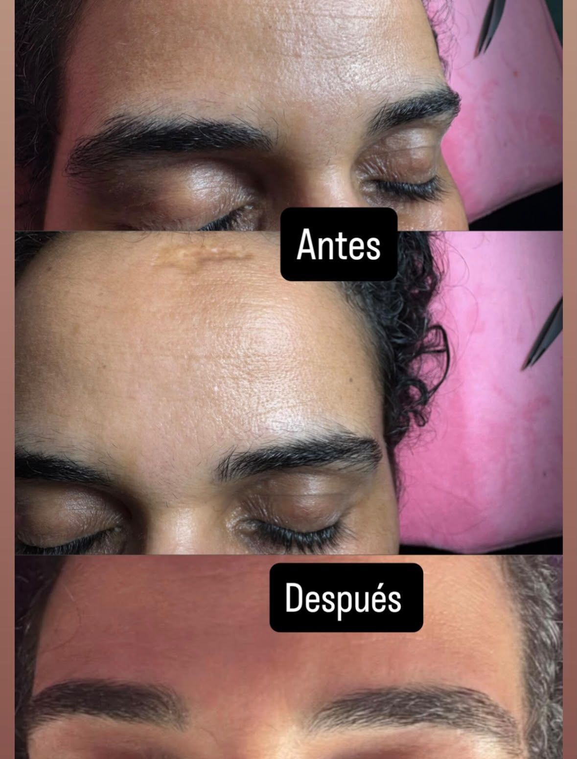 Collage de antes y después del arreglo de cejas, etiquetado como “Antes” y “Después”.