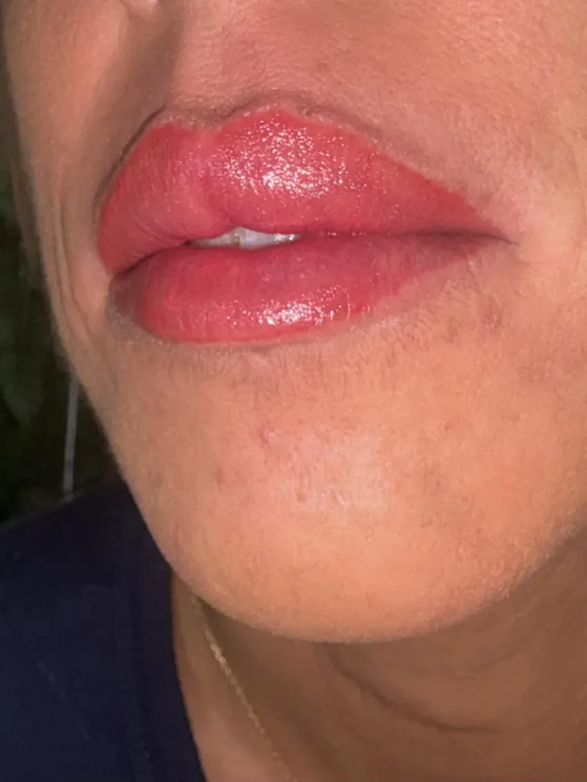Primer plano de labios rosados brillantes y la parte inferior del rostro sobre un fondo oscuro.