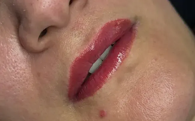 Primer plano de labios rosados brillantes y parte inferior del rostro con una pequeña imperfección en la barbilla.