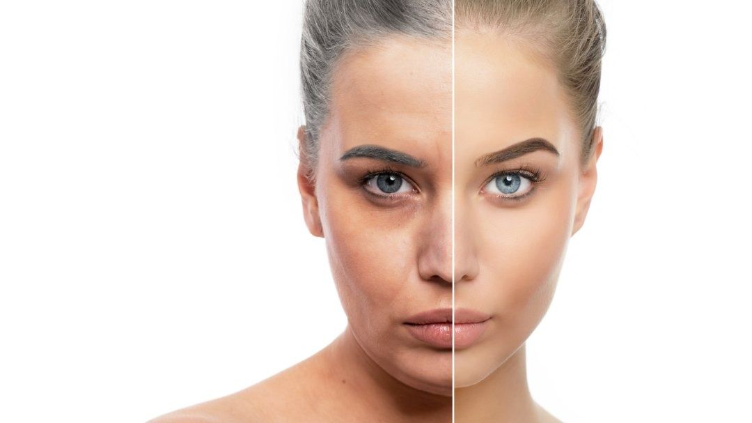 Una fotografía de antes y después del rostro de una mujer.