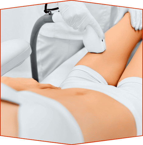 Un profesional que utiliza un dispositivo láser portátil para realizar un tratamiento de depilación en la pierna de un paciente.