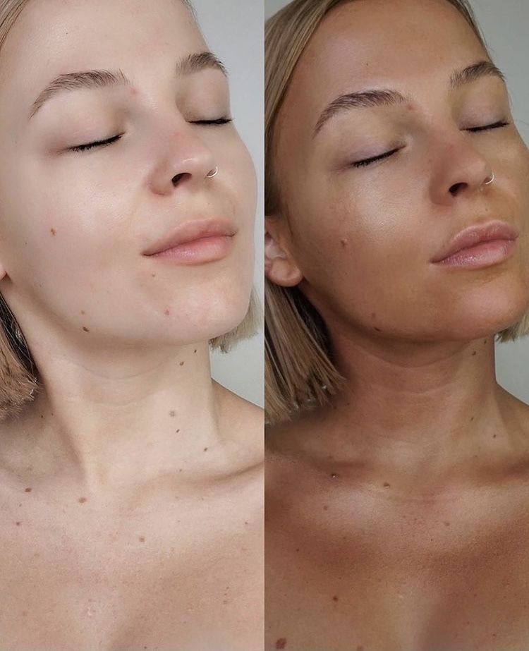 antes y despues de una mujer. En el lado izquierdo una mujer pálida y en el lado derecho morena.