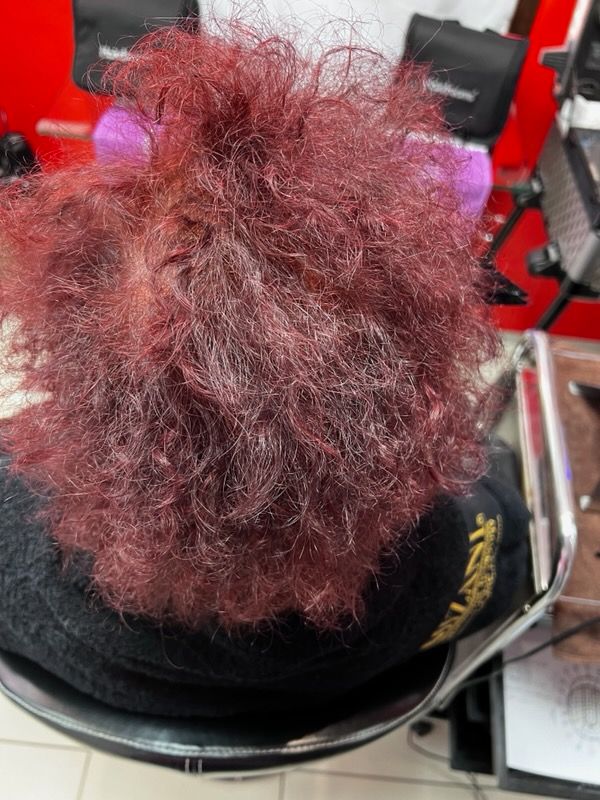 Des cheveux victimes d'alopécie