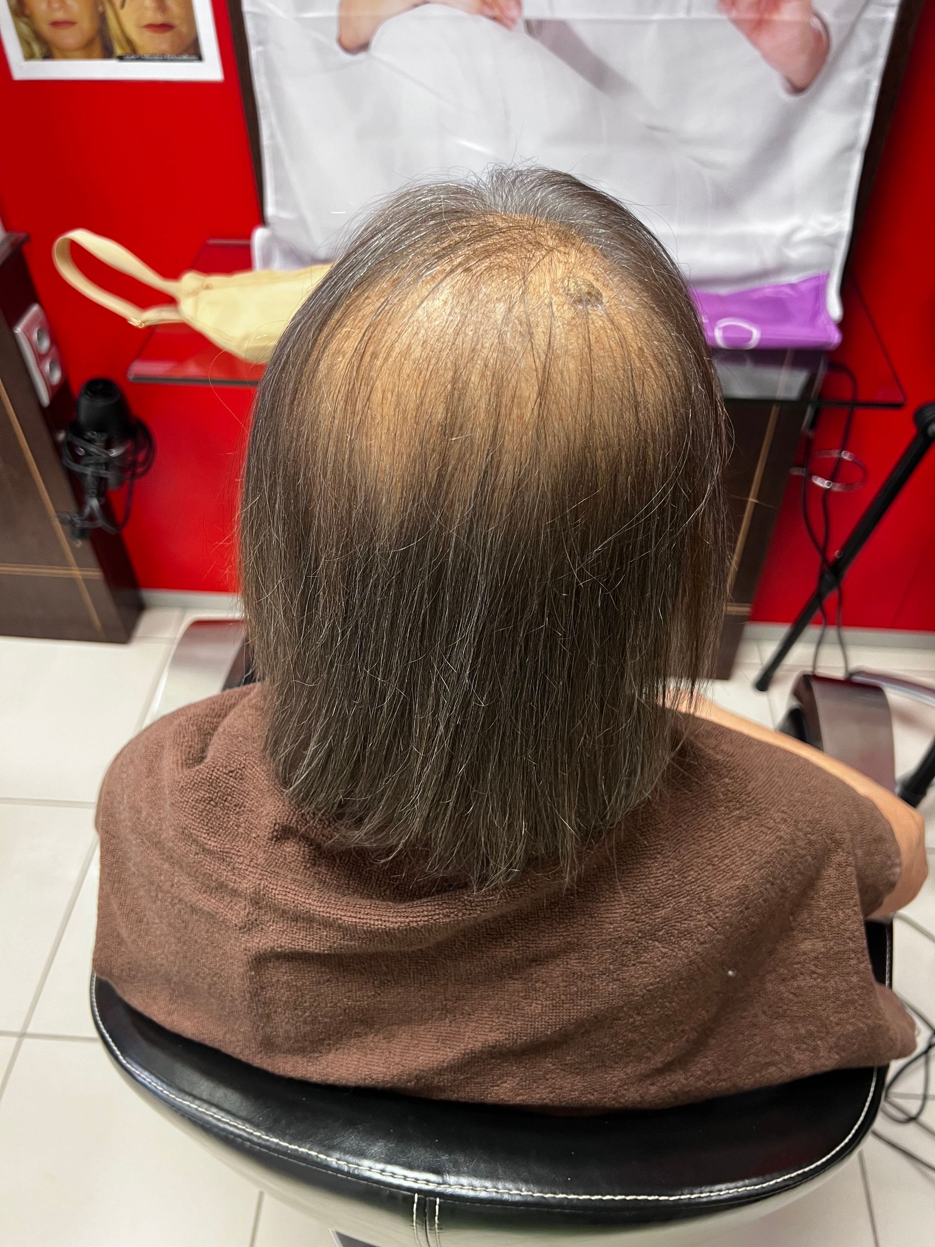 Des cheveux avant une pose microline