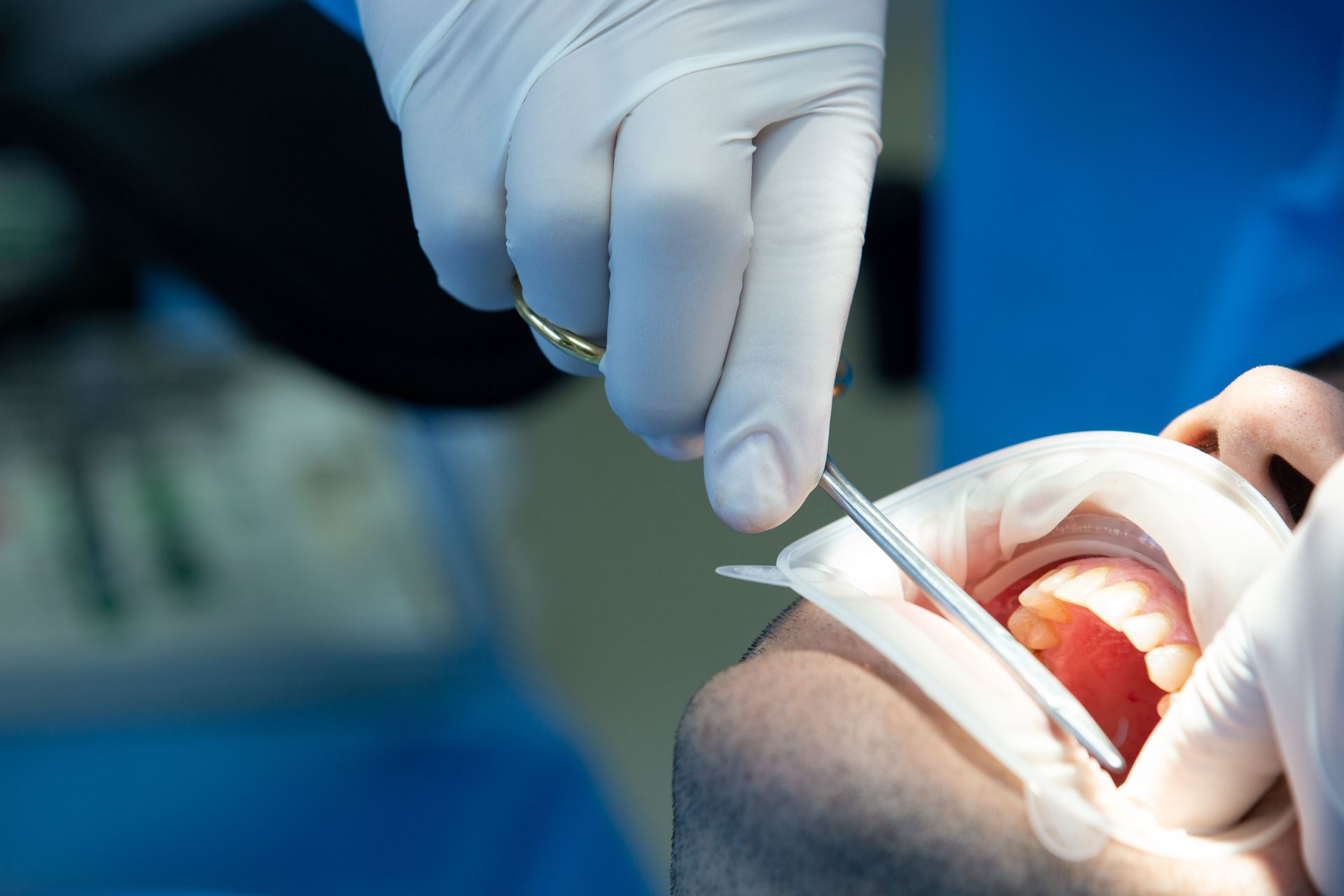 Odontólogo examinando la boca abierta de un paciente con guantes y herramientas dentales.