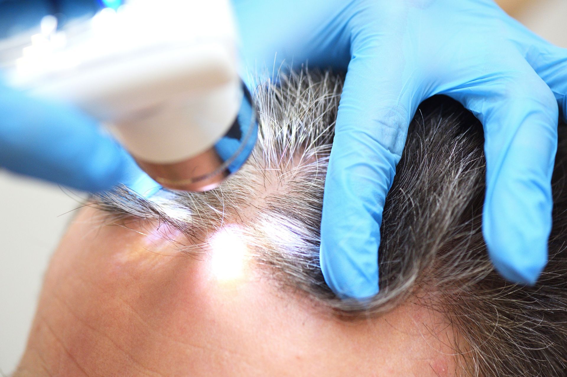 Micro-implantation capillaire