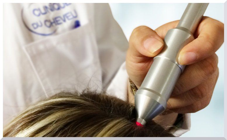 diagnostic capillaire à la clinique du cheveu