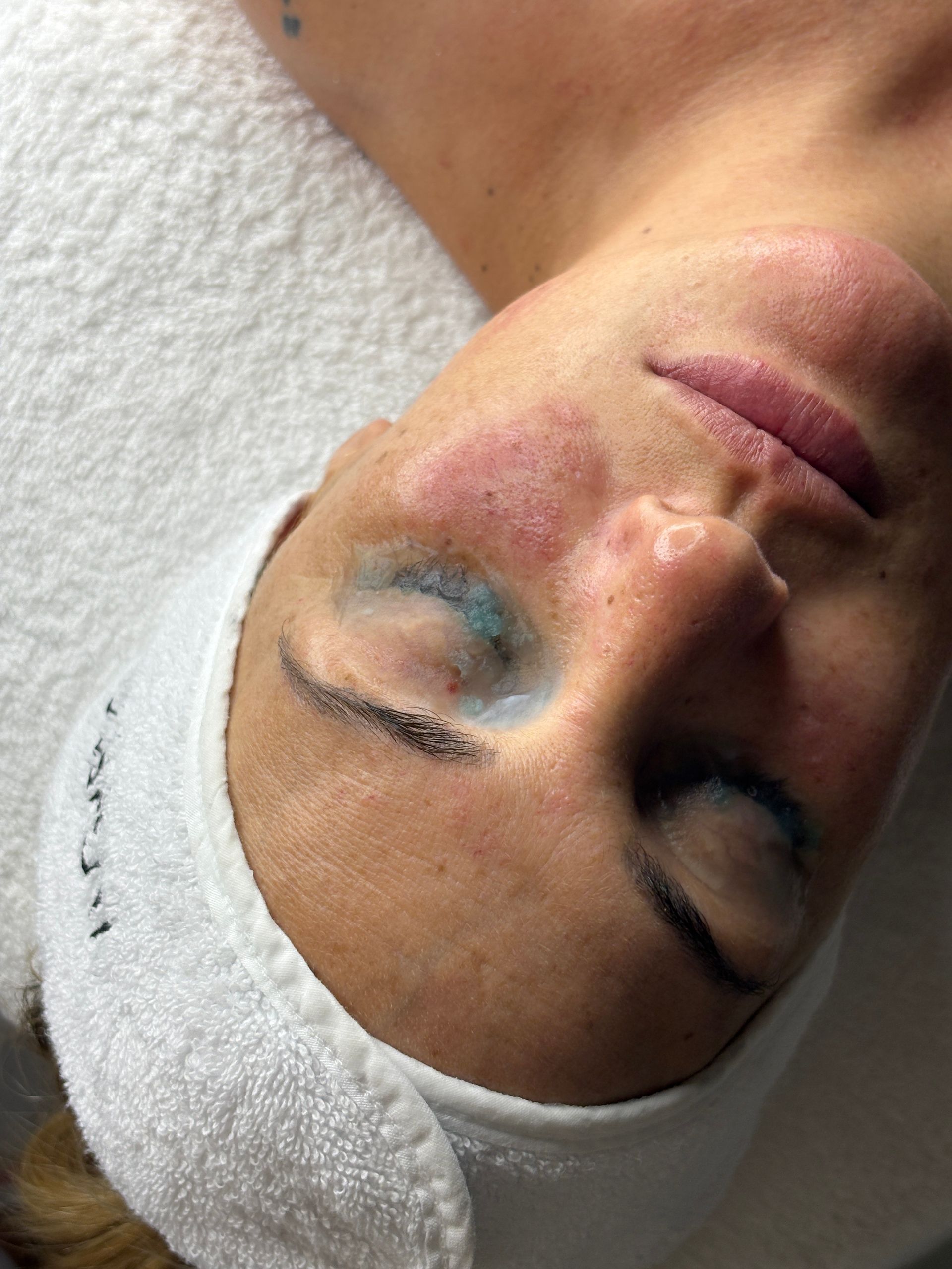 Mujer con los ojos cerrados, tumbada después de un tratamiento facial. Sombra de ojos azul, piel enrojecida y toalla blanca.