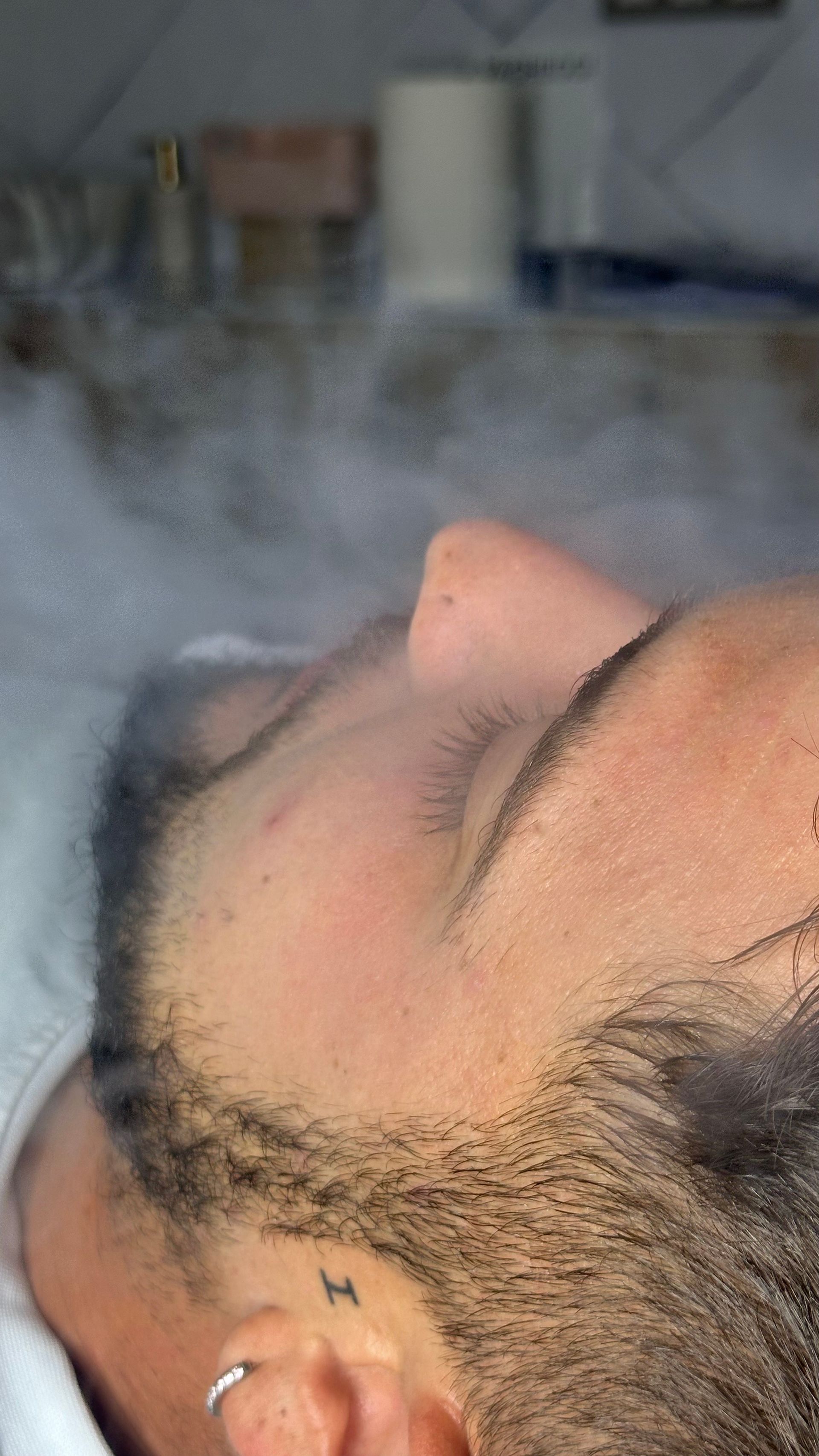 Persona recibiendo tratamiento de vapor facial; primer plano de la cara, vapor visible; tatuaje detrás de la oreja.