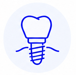 Implantes dentales en Madrid