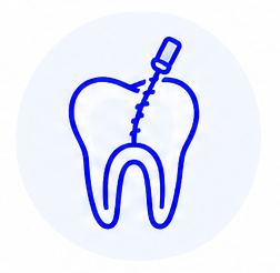 Endodoncia en Madrid