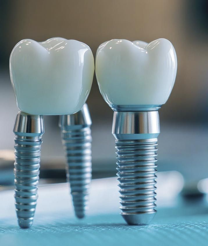 Dos implantes dentales están colocados uno al lado del otro en una mesa.