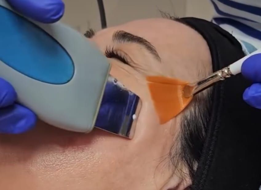 Una esteticista utiliza una espátula ultrasónica para la piel y un cepillo en abanico para realizar un tratamiento facial profesional.