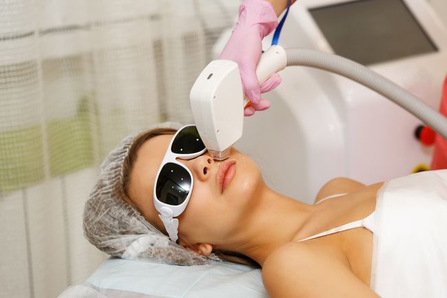 Persona recibiendo tratamiento láser en el rostro con gafas protectoras.