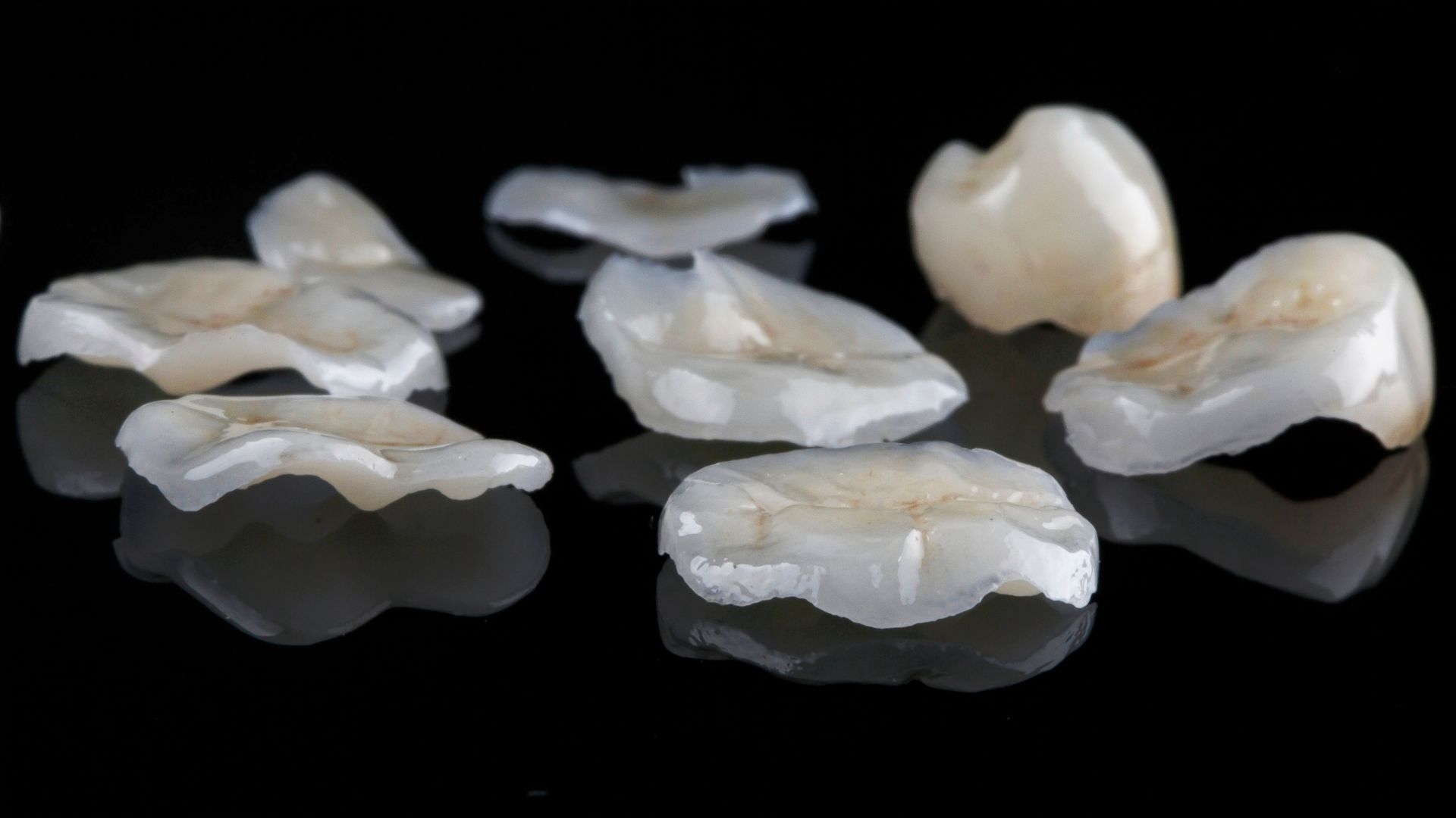 Différents types de prothèses dentaires inaly, onlay et overlay sur fond noir.