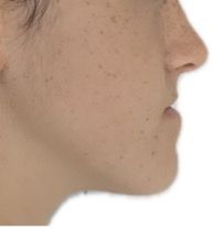 Photo avant Classe III