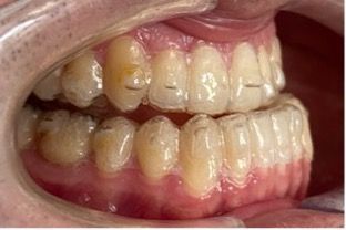 Photo avant Classe III