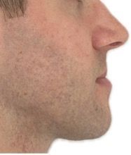 Photo avant Classe III