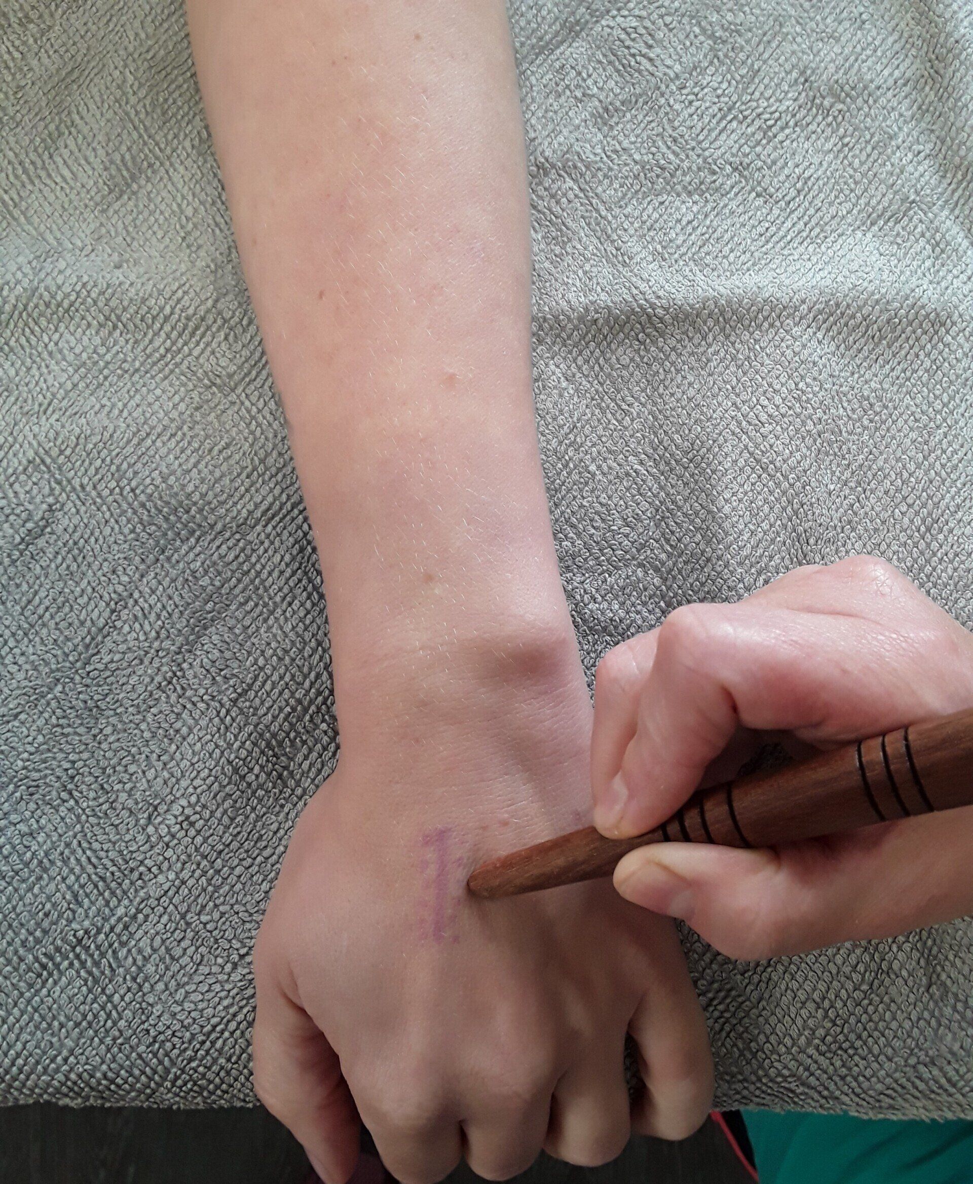 Hand und Handgelenk werden mit einem hölzernen Massagegerät auf einem grauen Handtuch behandelt.