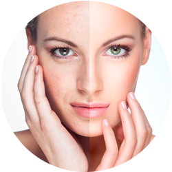 Rostro de mujer dividido: el lado izquierdo muestra imperfecciones; el lado derecho es liso, con rasgos realzados.