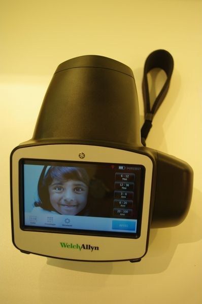 Una telecamera Welch Allyn ha la foto di un bambino sullo schermo