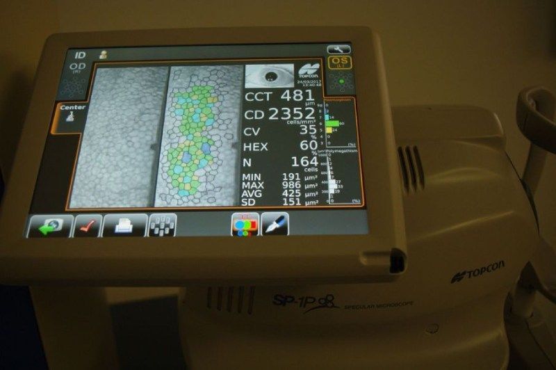 Un monitor di computer visualizza il numero 481