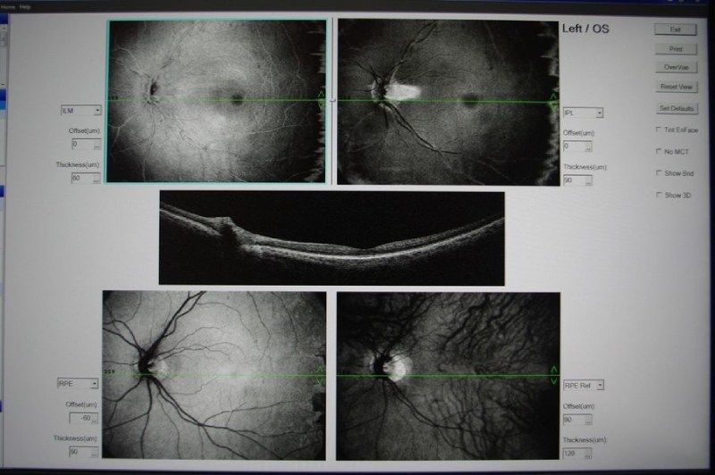 Uno schermo di computer mostra una serie di immagini dell'occhio di una persona