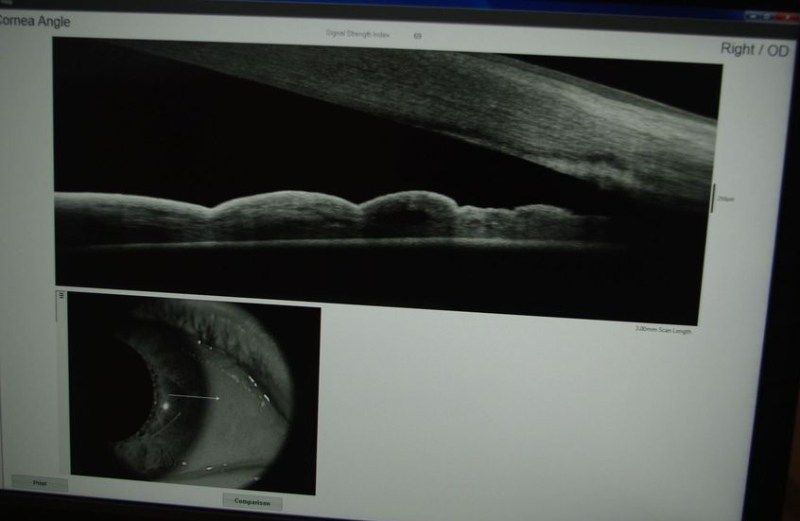 Un monitor di computer mostra un'immagine in bianco e nero di un occhio