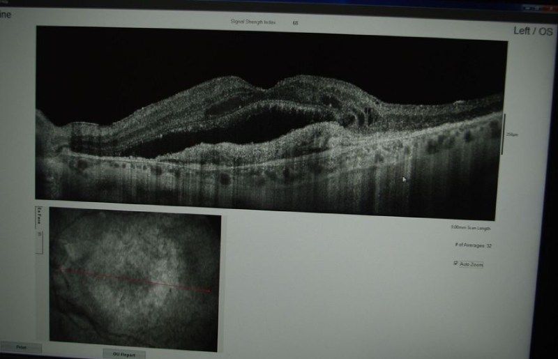 Un monitor di computer mostra un'immagine in bianco e nero di un occhio