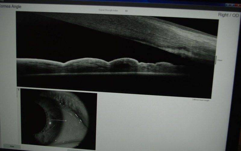 Un monitor di computer mostra un'immagine in bianco e nero di un occhio