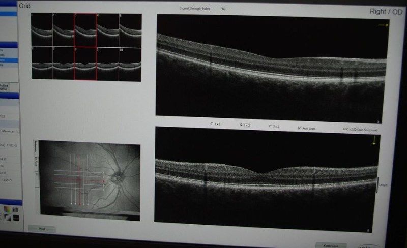 Un monitor di computer mostra alcune immagini dell'occhio di una persona