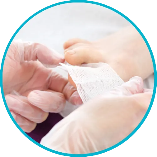 Manos con guantes envolviendo una gasa alrededor de los dedos de los pies de una persona.