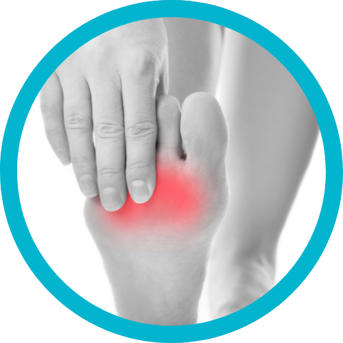 Persona que sostiene el pie, destacando el dedo gordo rojo e inflamado, lo que probablemente indica dolor.