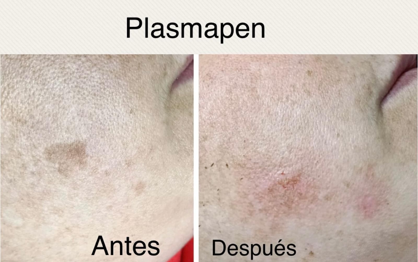 Una foto de antes y después de la cara de una persona.