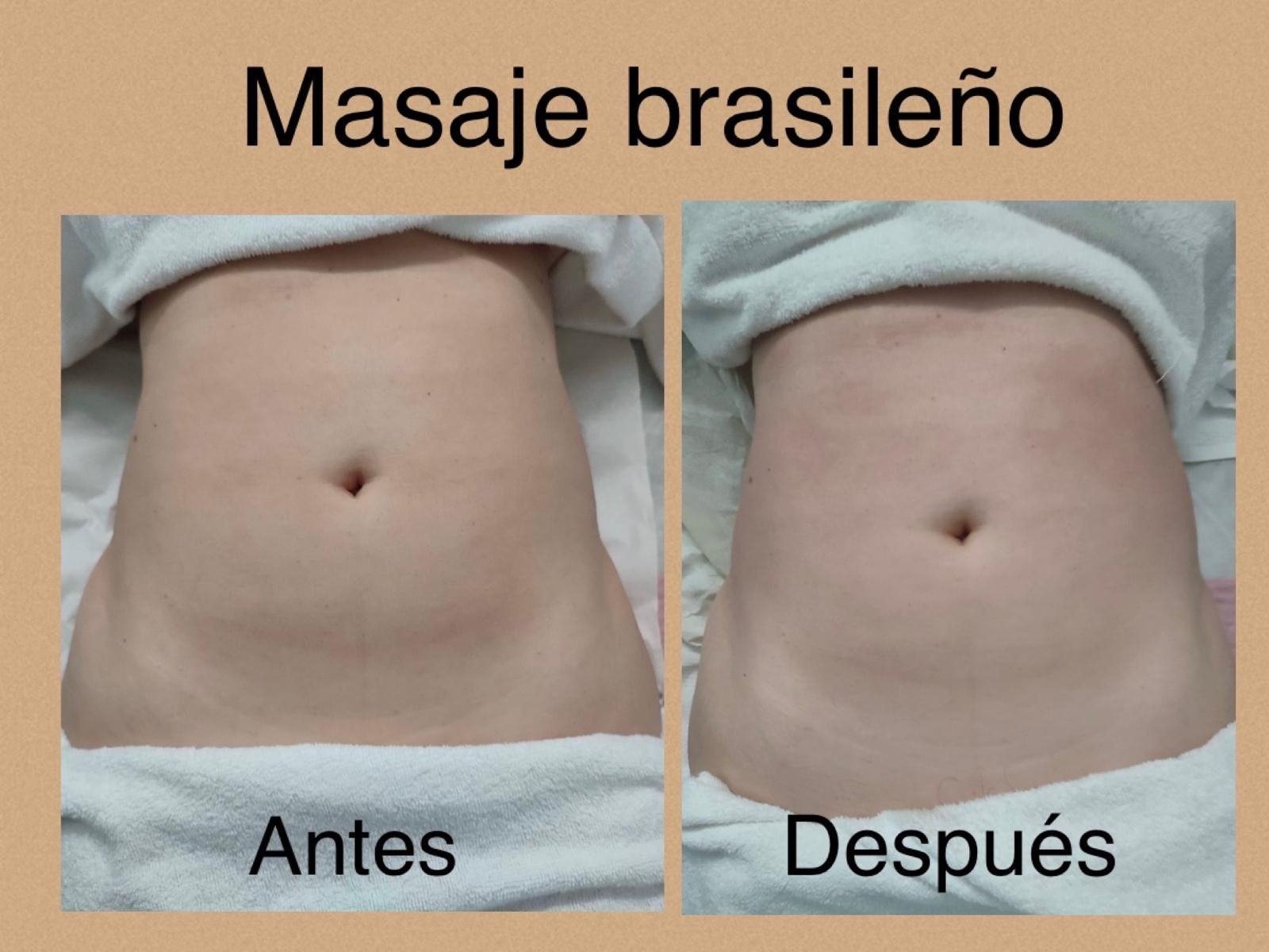 Una foto de antes y después del estómago de una mujer con las palabras