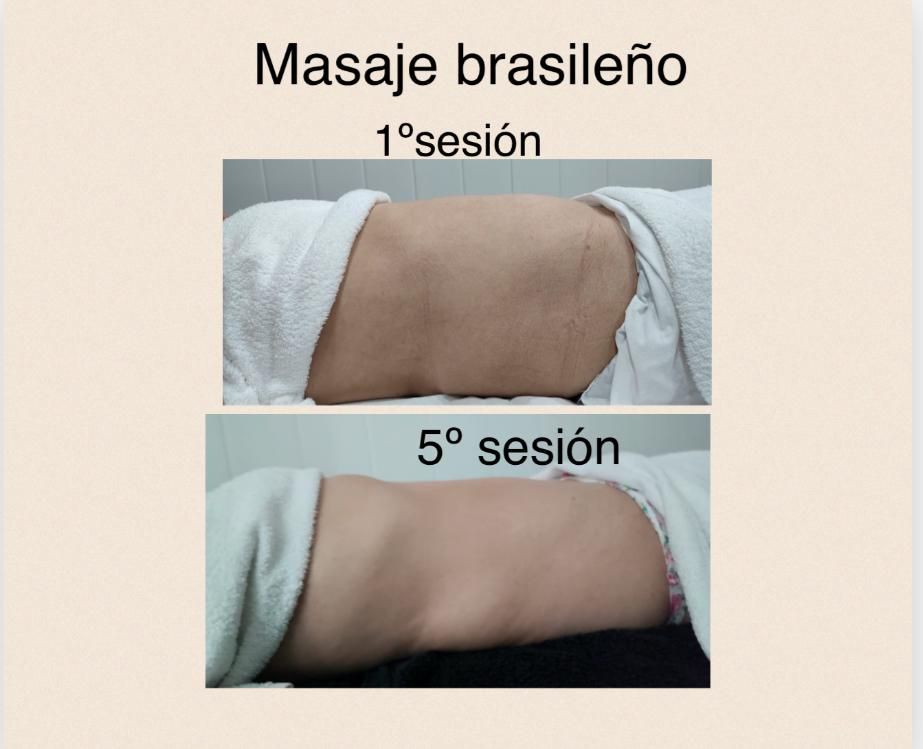 Una imagen del estómago de una persona antes y después de un masaje.