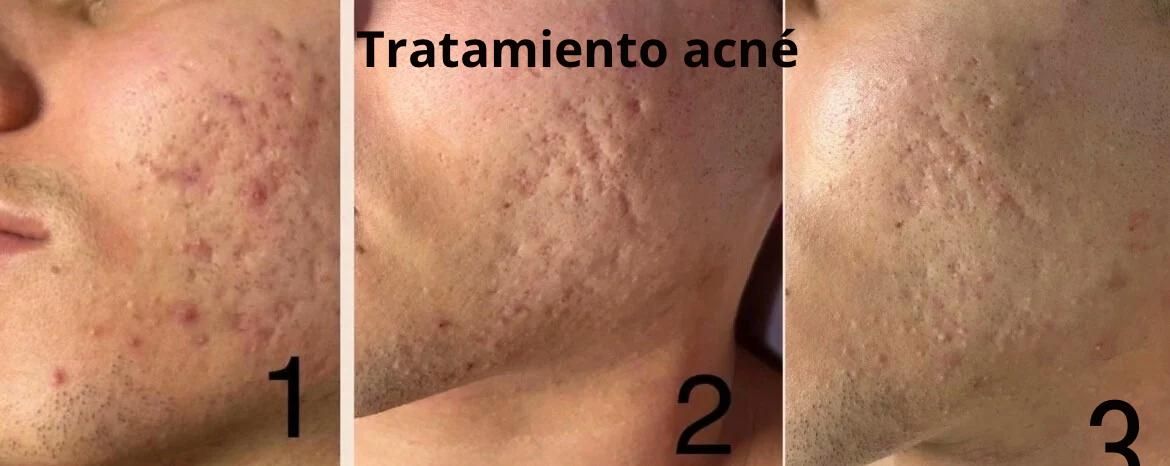 Tratamientos faciales Verónica Vico