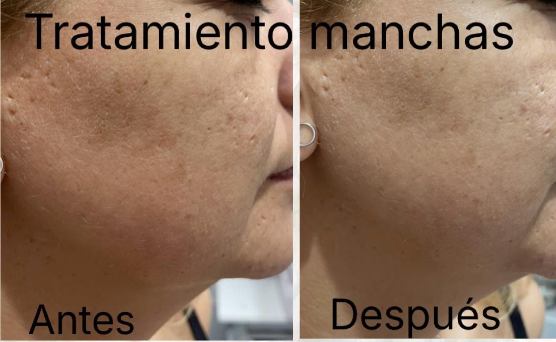 Tratamientos faciales Verónica Vico