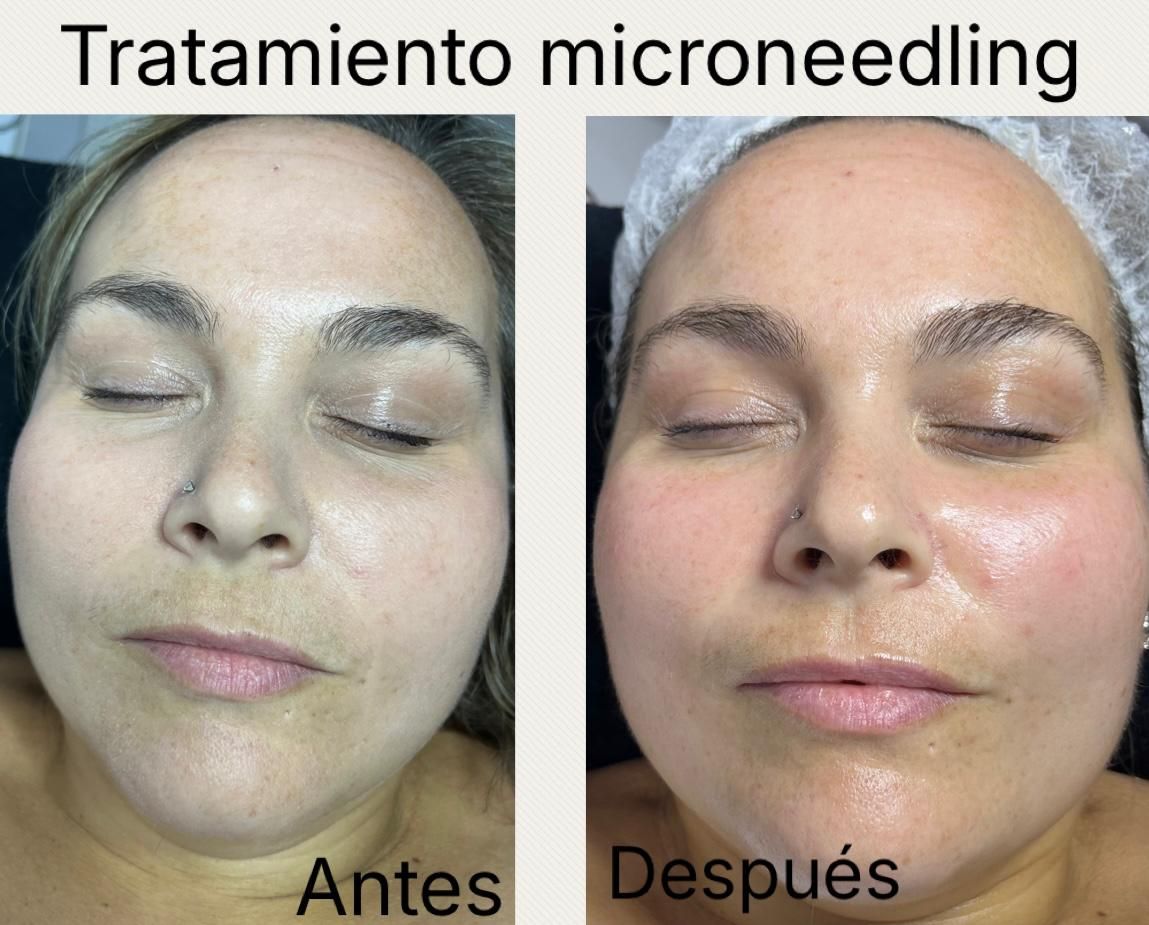 Tratamientos faciales Verónica Vico