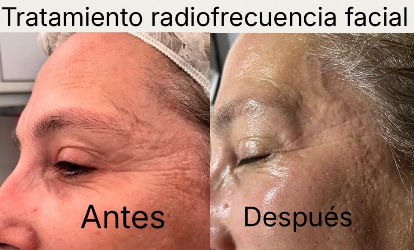 Tratamientos faciales Verónica Vico