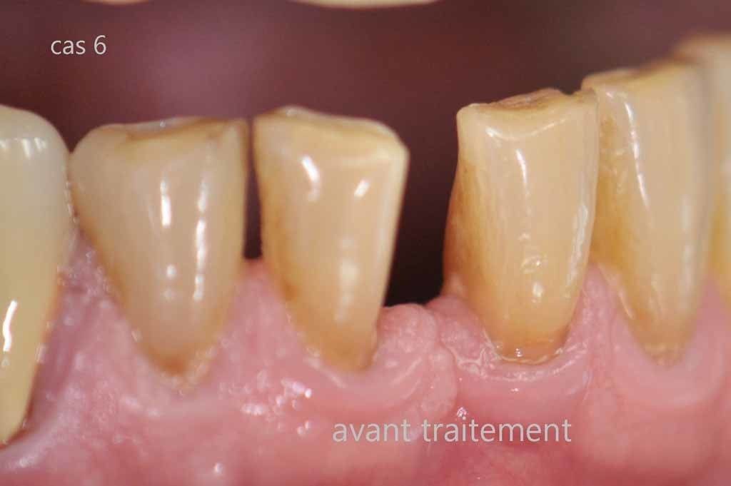 Dr Jean-Pierre Parisod - Bulle