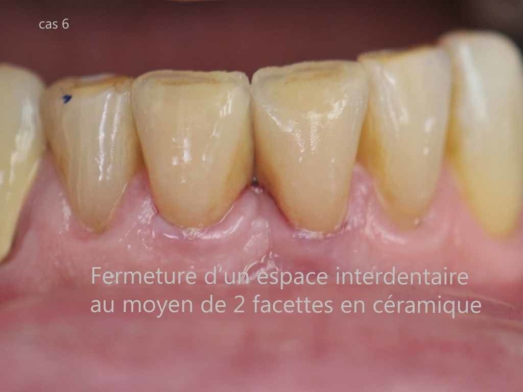 Dr Jean-Pierre Parisod - Bulle