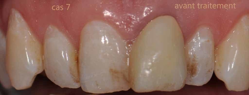 Dr Jean-Pierre Parisod - Bulle