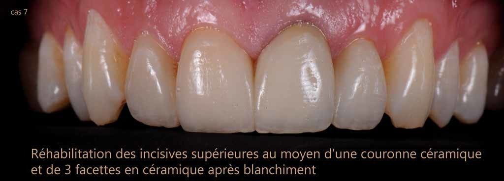 Dr Jean-Pierre Parisod - Bulle