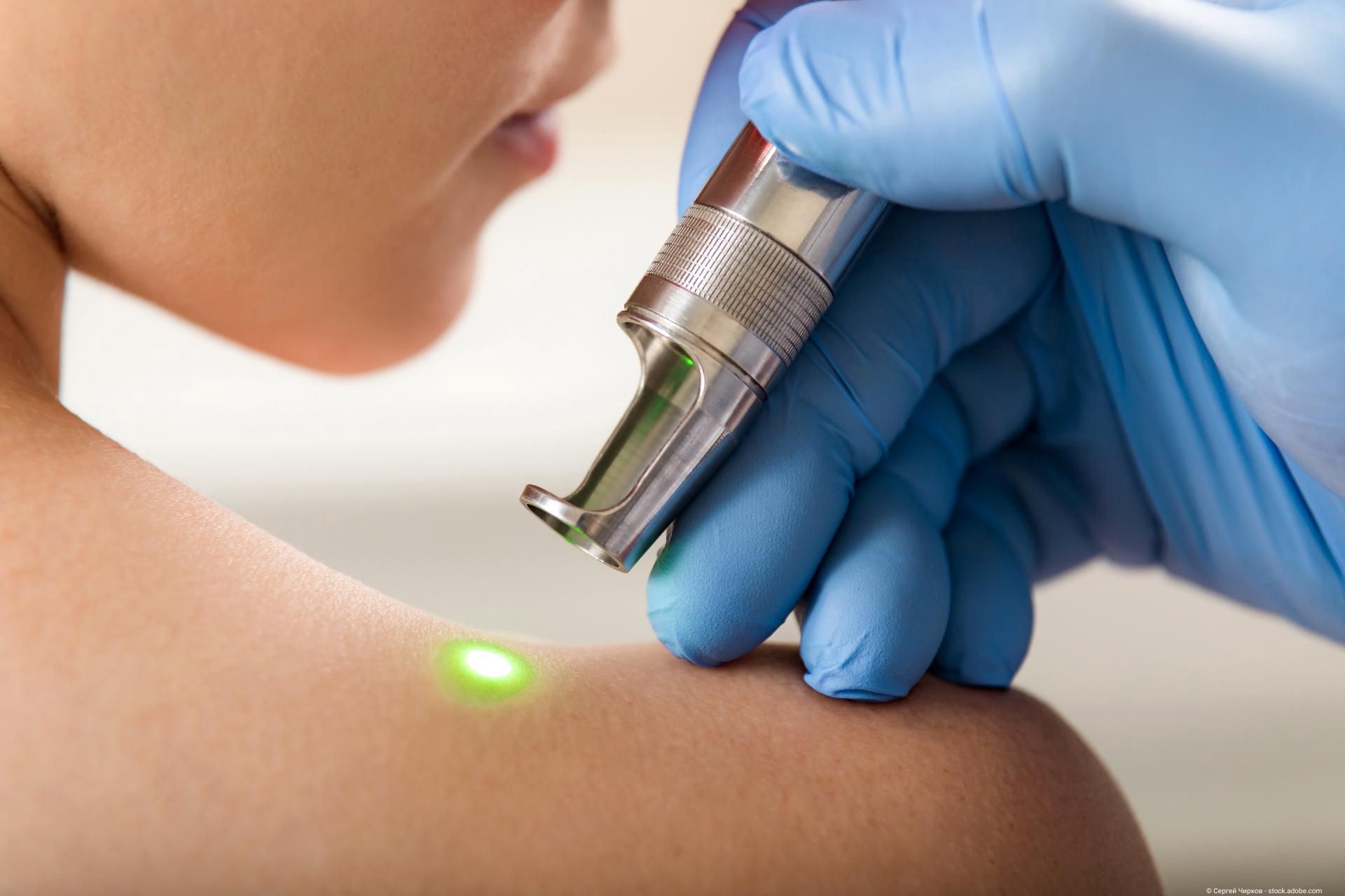 Lasertherapie für Hautbehandlungen und ästhetische Medizin