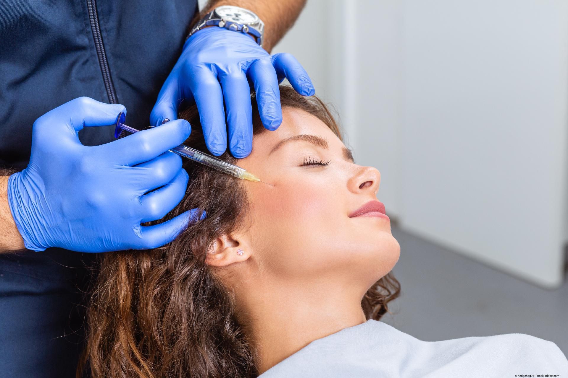 Faltenbehandlung mit Injektion zur Hautverjüngung und ästhetischen Medizin
