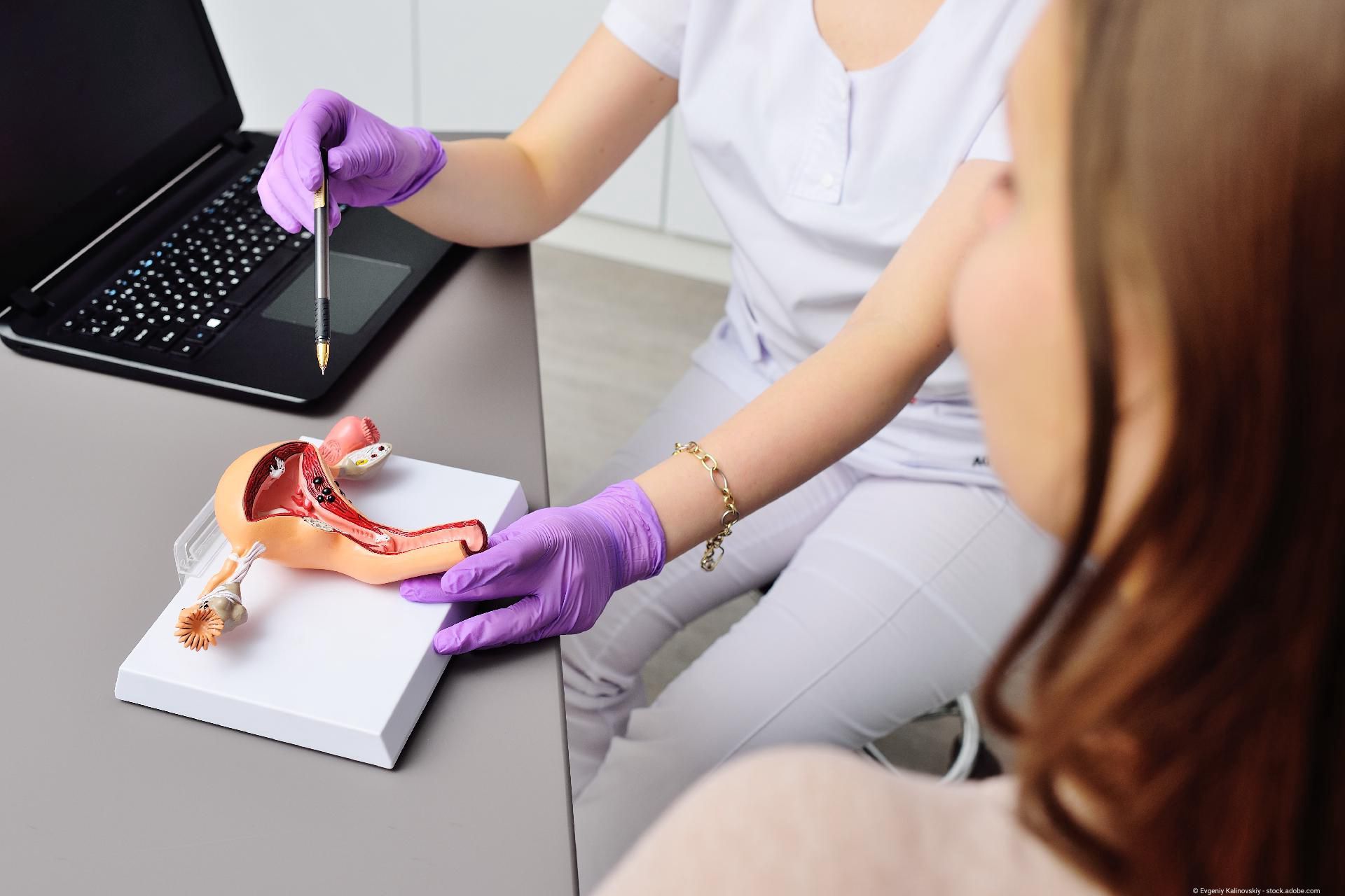 Beratung zur Frauengesundheit mit anatomischem Modell der Gebärmutter