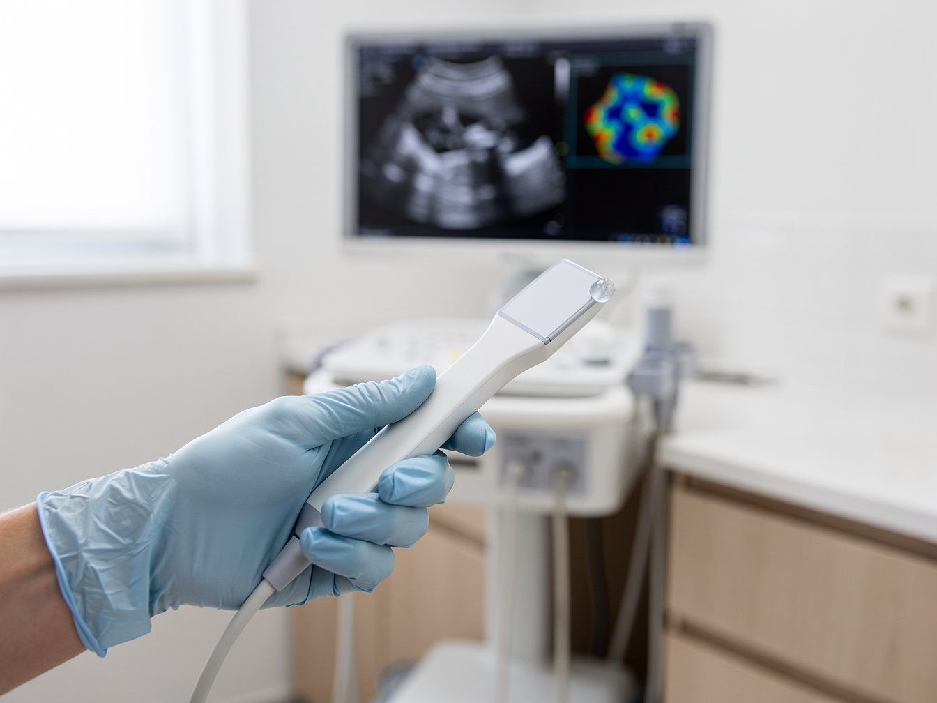 Schallkopf in behandschuhter Hand vor einem Ultraschallbild mit farbiger Elastographie